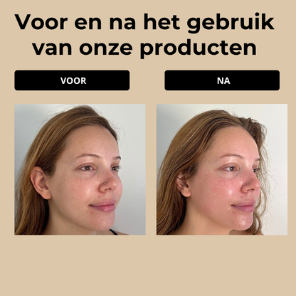 Glacielle™ Ice Beauty Roller – Verfris, Ontspan & Laat Je Huid Stralen